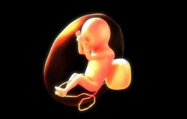 Tràn dịch màng phổi thai nhi là gì?