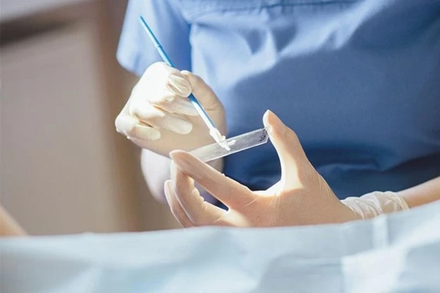 Phương pháp chẩn đoán phát hiện nhiễm HPV 