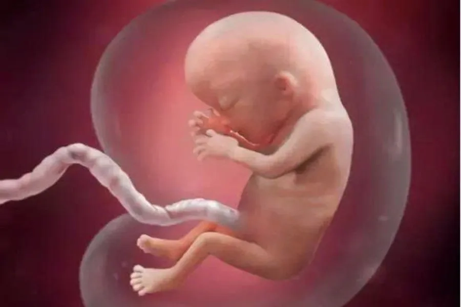 Màng ối bao bọc thai nhi, vỡ ối non xảy ra khi màng ối này bị rách và rò rỉ nước ra ngoài