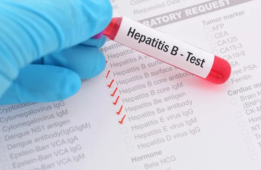 Xét nghiệm Anti-HBs giúp đánh giá miễn dịch với virus viêm gan B