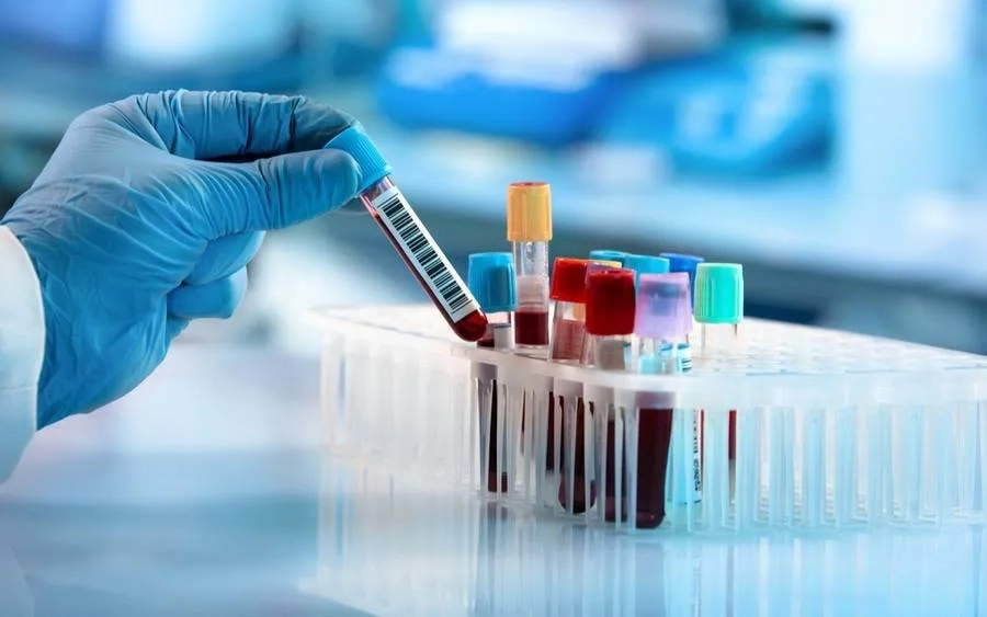 Xét nghiệm IgM và IgG giúp đánh giá tình trạng nhiễm sởi và khả năng miễn dịch với virus