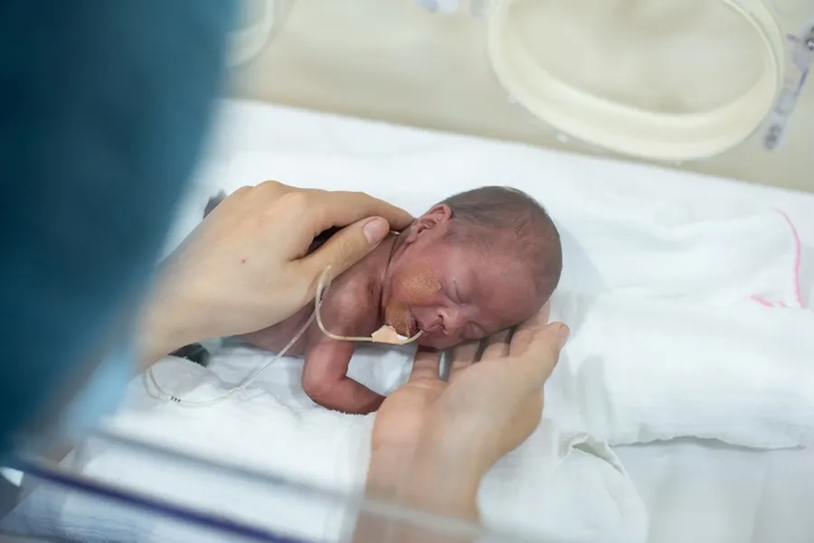 Sinh non, suy thai là một vấn đề thường xảy ra khi thiểu ối nặng 