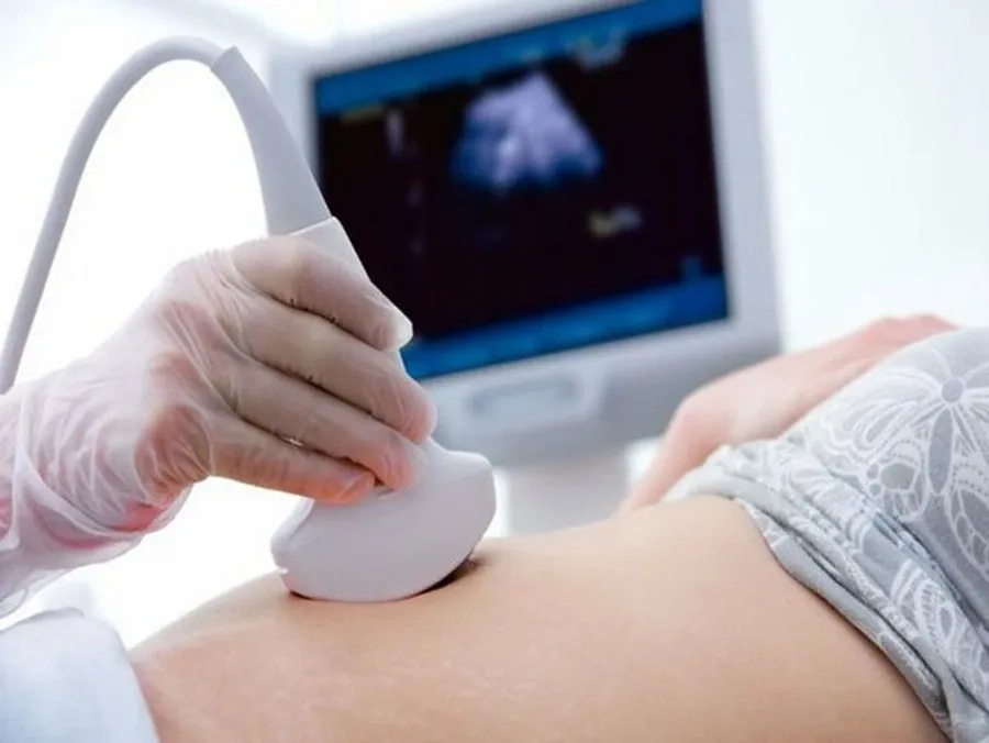 Siêu âm là cách xác định chính xác mức độ thiểu ối