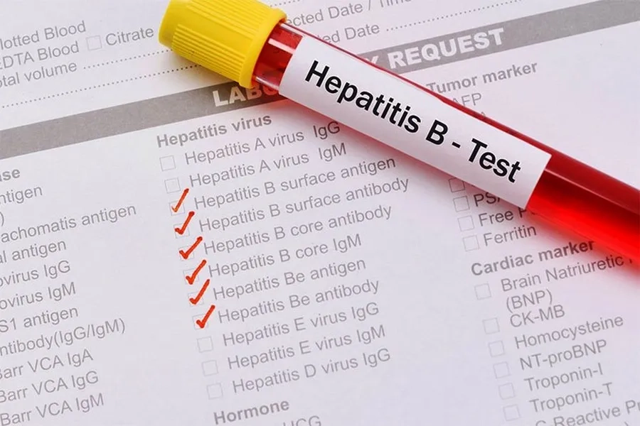Xét nghiệm Anti-HBs giúp phát hiện miễn dịch với virus viêm gan B