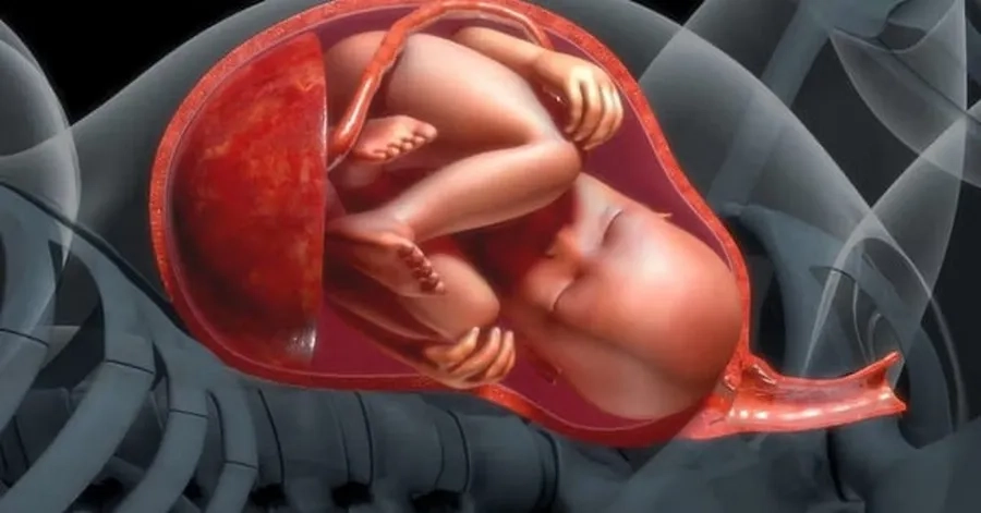 Dư ối là tình trạng nguy hiểm dễ gây biến chứng nên cần theo dõi thường xuyên