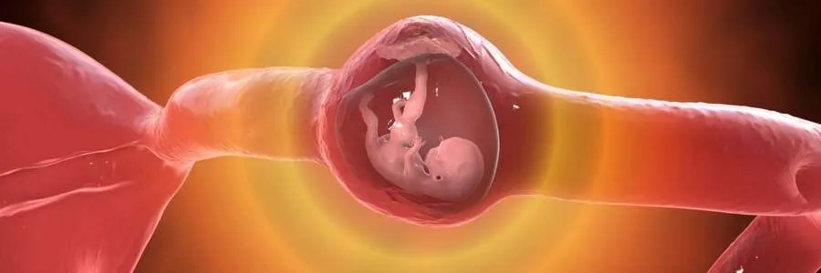 Chửa ngoài tử cung có thể gây tổn thương ống dẫn trứng 