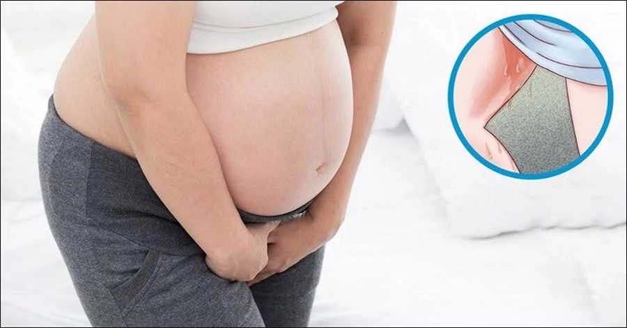 Màng ối rò rỉ cũng là lý do tại sao uống nhiều nước mà vẫn ít ối