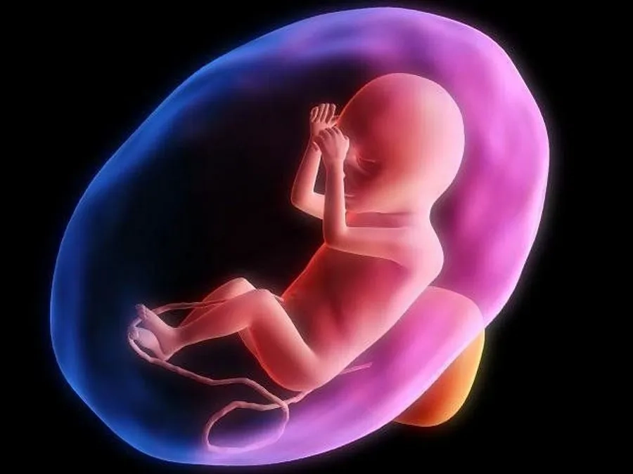 Đa ối ở tuần 36 là lượng nước ối lớn hơn bình thường so với tuổi thai