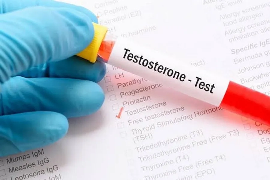 Xét nghiệm Testosterone giúp kiểm tra chức năng sinh sản ở nam giới