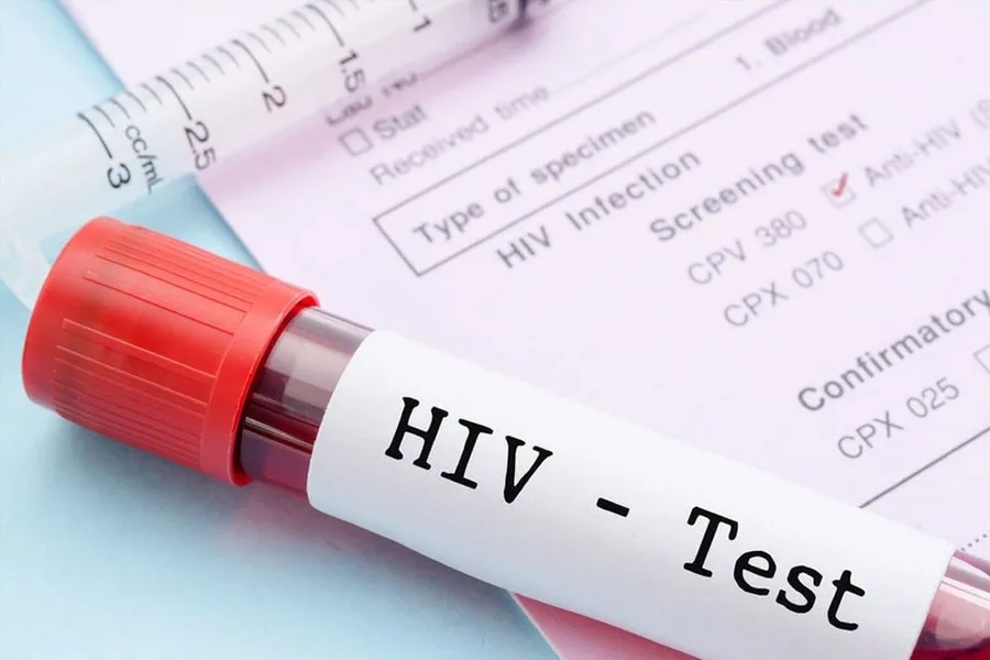 Xét nghiệm HIV là một trong những xét nghiệm tầm soát bệnh lây nhiễm không thể thiếu