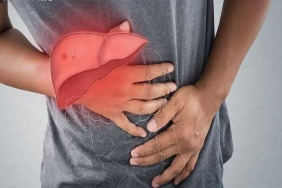 Đau bụng bên sườn phải là biểu hiện của bệnh gan nhiễm mỡ