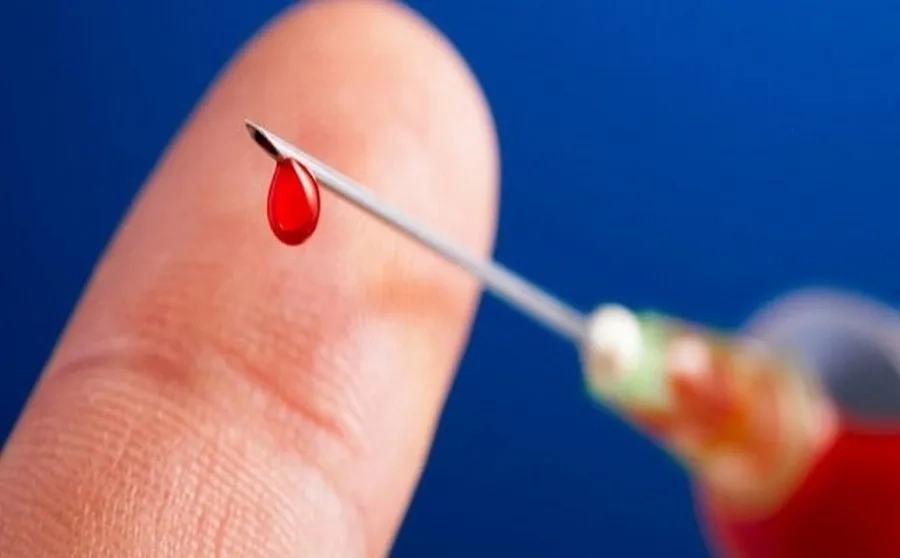 Người có nguy cơ phơi nhiễm cao cần được tiêm huyết thanh phòng ngừa