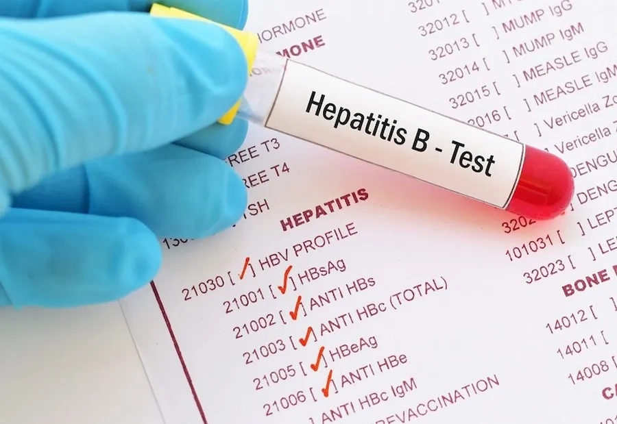 Xét nghiệm Anti-HBs giúp đánh giá miễn dịch chống lại virus viêm gan B