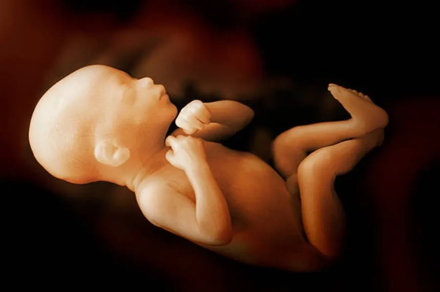 Thalassemia có thể gây phù thai, lưu thai, thậm chí tử vong ngay sau sinh