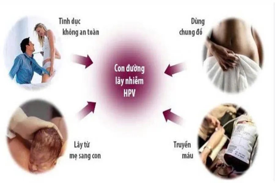 Tiêm HPV là cách tốt nhất để phòng ngừa lây lan virus HPV