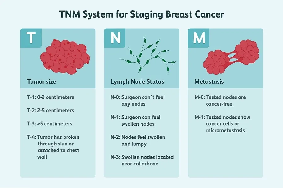 N0 nghĩa là chưa phát hiện hạch; N1-N3 cho thấy các mức độ di căn hạch khác nhau