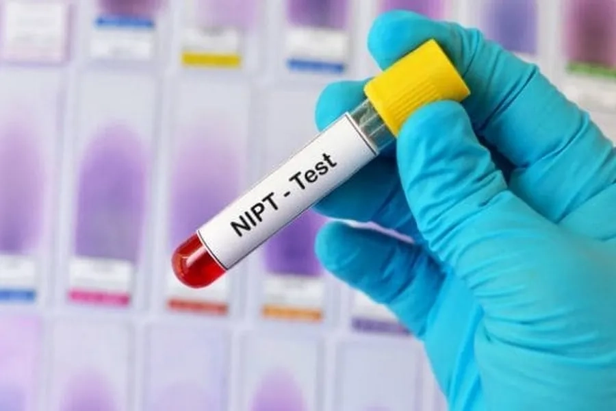 Xét nghiệm NIPT có thể thực hiện từ tuần thứ 10 của thai kỳ, có thể sàng lọc mở rộng đến các bất thường mất đoạn, lặp đoạn nhiễm sắc thể