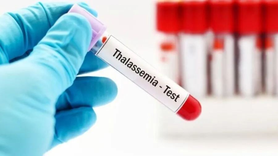 Tầm soát sớm Thalassemia giúp phòng ngừa sinh con mắc bệnh thể nặng