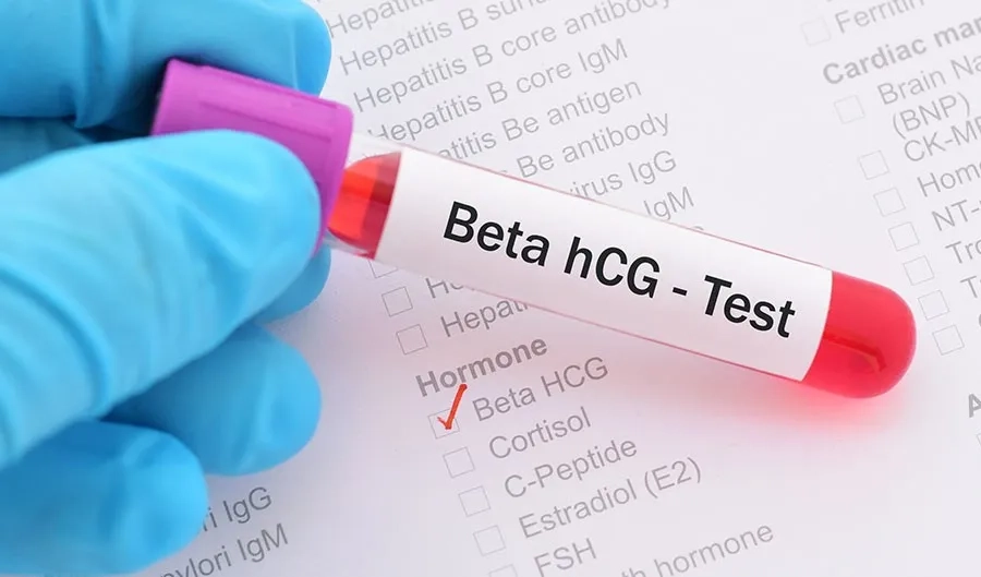 Xét nghiệm định lượng hCG giúp đo chính xác nồng độ hormone hCG trong máu