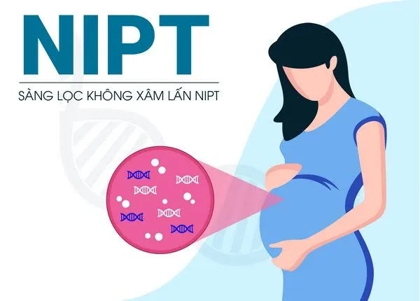 Xét nghiệm NIPT có thể được thực hiện từ tuần 10 của thai kỳ để phát hiện sớm bất thường nhiễm sắc thể