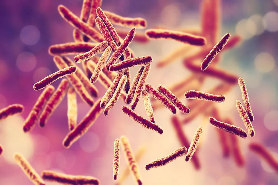 Vi khuẩn Mycobacterium tuberculosis là tác nhân gây lao phổi