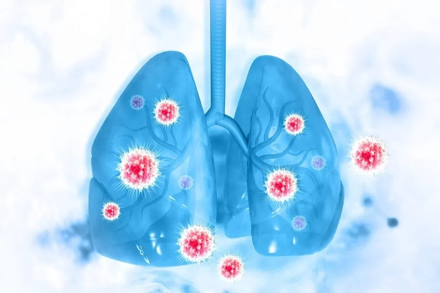 Virus là nguyên nhân phổ biến nhất gây viêm phế quản cấp