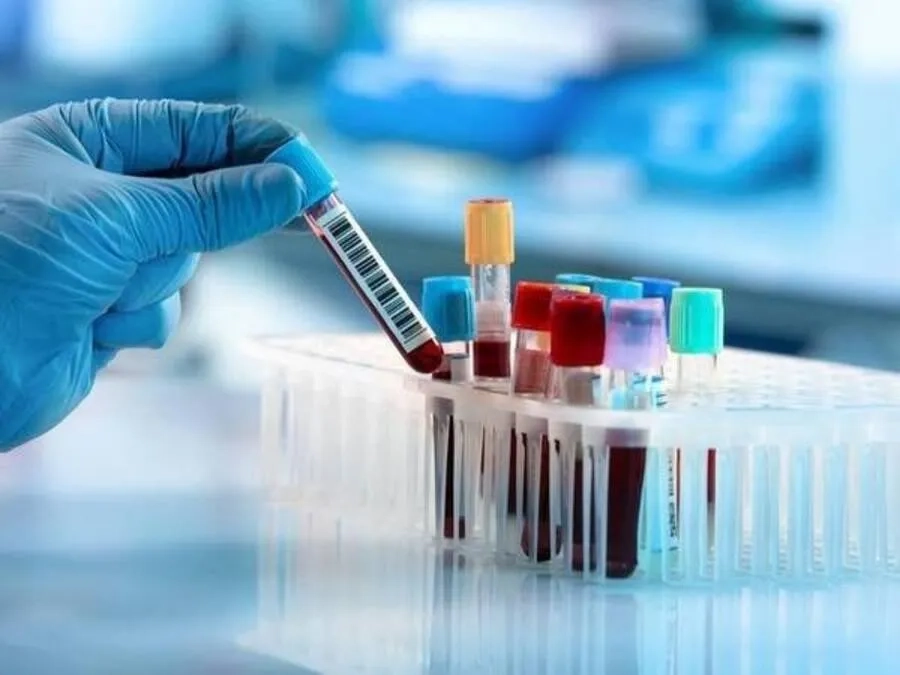 Xét nghiệm máu hỗ trợ đánh giá đường huyết, đông máu và các chỉ số cần thiết