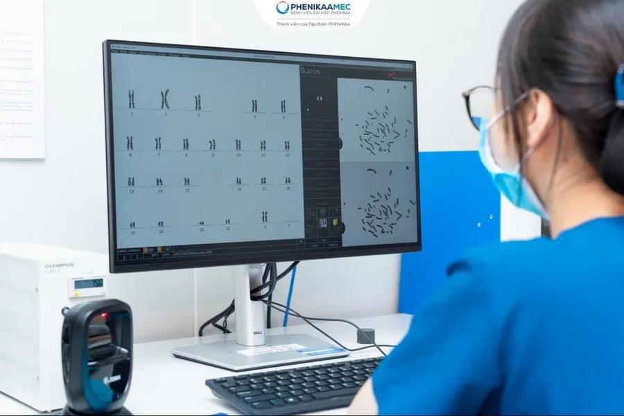 Xét nghiệm nhiễm sắc thể đồ (Karyotype) phát hiện bộ nhiễm sắc thể 47,XYY