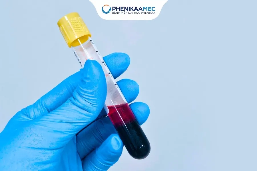 Xét nghiệm NIPT giúp sàng lọc bất thường nhiễm sắc thể giai đoạn sớm