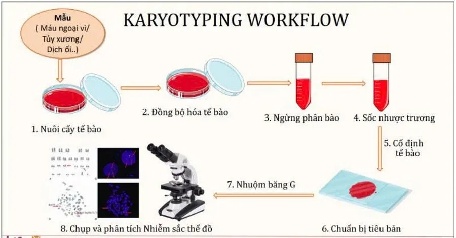 Xét nghiệm nhiễm sắc thể đồ (Karyotype) được chỉ định trong các trường hợp nghi ngờ hội chứng Triple X