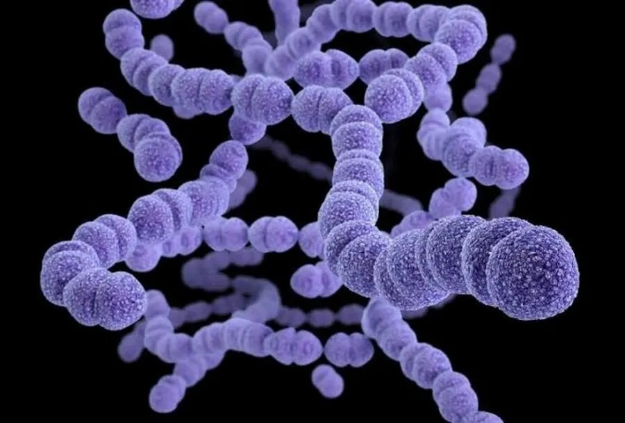 Phế cầu là tác nhân thường gặp gây viêm phổi ở người lớn
